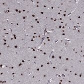 Anti-RARB antibody produced in rabbit Prestige Antibodies® Powered by Atlas Antibodies, affinity isolated antibody, buffered aqueous glycerol solution