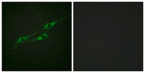 Anti-IL-13R antibody produced in rabbit affinity isolated antibody