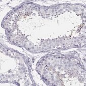 Anti-SPATA12 antibody produced in rabbit Prestige Antibodies&#174; Powered by Atlas Antibodies, affinity isolated antibody, buffered aqueous glycerol solution