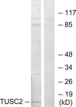 Anti-TUSC2 antibody produced in rabbit affinity isolated antibody