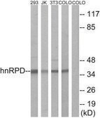 Anti-HNRPD antibody produced in rabbit affinity isolated antibody