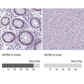 Anti-SATB2 antibody produced in rabbit Prestige Antibodies® Powered by Atlas Antibodies, affinity isolated antibody, buffered aqueous glycerol solution