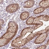 Anti-B3GALT5 antibody produced in rabbit Prestige Antibodies&#174; Powered by Atlas Antibodies, affinity isolated antibody, buffered aqueous glycerol solution