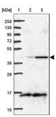 Anti-BCS1L antibody produced in rabbit Prestige Antibodies® Powered by Atlas Antibodies, affinity isolated antibody, buffered aqueous glycerol solution