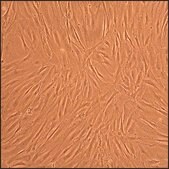 Human Osteoblasts-Rheumatoid Arthritis: HOb-RA, adult