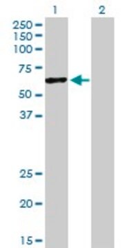 Anti-HERPUD1 antibody produced in rabbit purified immunoglobulin, buffered aqueous solution
