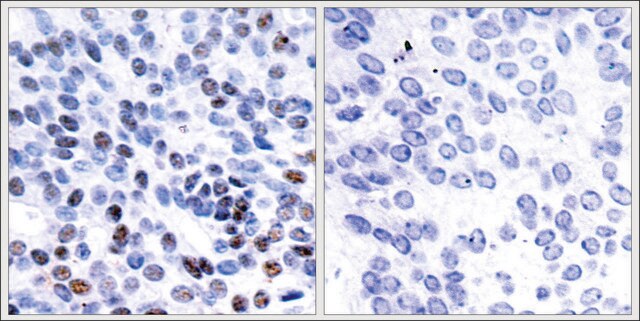Anti-JUNB (Ab-259) antibody produced in rabbit affinity isolated antibody