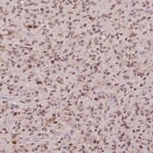 Anti-PRRX1 antibody produced in rabbit Prestige Antibodies® Powered by Atlas Antibodies, affinity isolated antibody, buffered aqueous glycerol solution