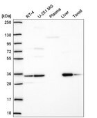 Anti-TMEM183A antibody produced in rabbit Prestige Antibodies® Powered by Atlas Antibodies, affinity isolated antibody