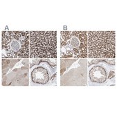 Anti-ABCD3 antibody produced in rabbit Prestige Antibodies® Powered by Atlas Antibodies, affinity isolated antibody, buffered aqueous glycerol solution