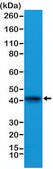 Anti-alpha-Cardiac Actin (ACTC1) antibody, Rabbit monoclonal recombinant, expressed in HEK 293 cells, clone RM257, purified immunoglobulin