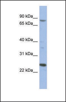 Anti-MARK3 antibody produced in rabbit affinity isolated antibody