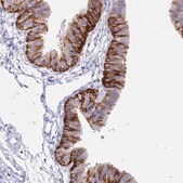 Anti-NLRP12 antibody produced in rabbit Prestige Antibodies&#174; Powered by Atlas Antibodies, affinity isolated antibody, buffered aqueous glycerol solution