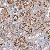 Anti-DCTN6 antibody produced in rabbit Prestige Antibodies&#174; Powered by Atlas Antibodies, affinity isolated antibody, buffered aqueous glycerol solution, Ab1
