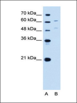 Anti-UGT1A4 antibody produced in rabbit affinity isolated antibody