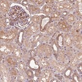 Anti-CNN3 antibody produced in rabbit Prestige Antibodies&#174; Powered by Atlas Antibodies, affinity isolated antibody, buffered aqueous glycerol solution