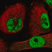 Anti-ZNF326 antibody produced in rabbit Prestige Antibodies&#174; Powered by Atlas Antibodies, affinity isolated antibody, buffered aqueous glycerol solution, ab2