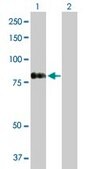 Anti-RASGRP4 antibody produced in rabbit purified immunoglobulin, buffered aqueous solution