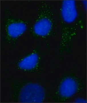 Anti-Rab7 antibody, Mouse monoclonal ~2&#160;mg/mL, clone Rab7-117, purified from hybridoma cell culture