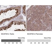 Anti-BCAP29 antibody produced in rabbit Prestige Antibodies® Powered by Atlas Antibodies, affinity isolated antibody, buffered aqueous glycerol solution