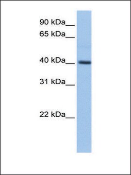 Anti-PDXK (AB2) antibody produced in rabbit affinity isolated antibody