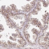 Anti-IDUA antibody produced in rabbit Prestige Antibodies&#174; Powered by Atlas Antibodies, affinity isolated antibody, buffered aqueous glycerol solution
