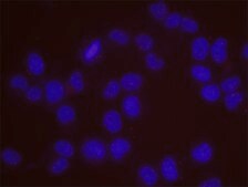 ATM and SMC3 PLA&#174; Antibody Kit Powered by Bethyl Laboratories, Inc.