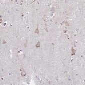 Anti-HTR2A antibody produced in rabbit Prestige Antibodies&#174; Powered by Atlas Antibodies, affinity isolated antibody, buffered aqueous glycerol solution