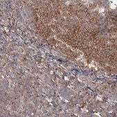 Anti-CCNG2 antibody produced in rabbit Prestige Antibodies® Powered by Atlas Antibodies, affinity isolated antibody, buffered aqueous glycerol solution