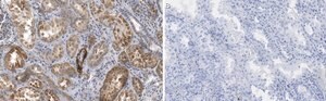 Anti-Endoglin Antibody, clone 1I15 ZooMAb&#174; Rabbit Monoclonal recombinant, expressed in HEK 293 cells