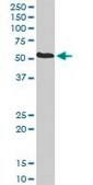 Anti-PDIA5 antibody produced in rabbit purified immunoglobulin, buffered aqueous solution