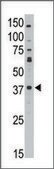 Anti-MAGEA10 (C-term) antibody produced in rabbit IgG fraction of antiserum, buffered aqueous solution