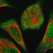 Anti-FAM104A antibody produced in rabbit Prestige Antibodies&#174; Powered by Atlas Antibodies, affinity isolated antibody, buffered aqueous glycerol solution