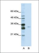 Anti-SFRS1 (AB1) antibody produced in rabbit affinity isolated antibody