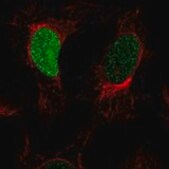 Anti-H1-1 antibody produced in rabbit Prestige Antibodies&#174; Powered by Atlas Antibodies, affinity isolated antibody, buffered aqueous glycerol solution