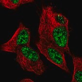 Anti-ZNF233 antibody produced in rabbit Prestige Antibodies&#174; Powered by Atlas Antibodies, affinity isolated antibody, buffered aqueous glycerol solution
