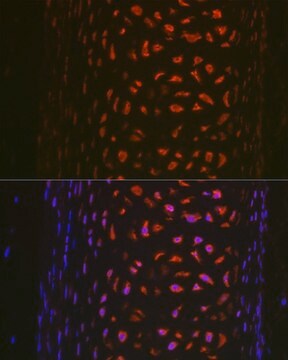 Anti- MMP13 antibody produced in rabbit