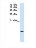 Anti-C3ORF10 antibody produced in rabbit IgG fraction of antiserum