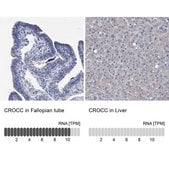 Anti-CROCC antibody produced in rabbit Prestige Antibodies® Powered by Atlas Antibodies, affinity isolated antibody, buffered aqueous glycerol solution, Ab2