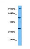 Anti-TCF7L2 antibody produced in rabbit affinity isolated antibody