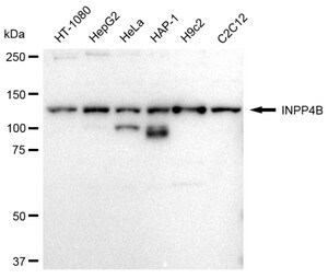 Anti INPP4B Antibody, clone 23GB2530, Rabbit Monoclonal clone 23GB2530, recombinant rabbit monoclonal, expressed in HEK293 cells
