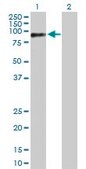 Anti-RAD18 antibody produced in rabbit purified immunoglobulin, buffered aqueous solution