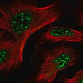 Anti-POMP antibody produced in rabbit Prestige Antibodies&#174; Powered by Atlas Antibodies, affinity isolated antibody, buffered aqueous glycerol solution