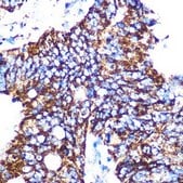 Anti-GC1q R/C1QBP antibody produced in rabbit