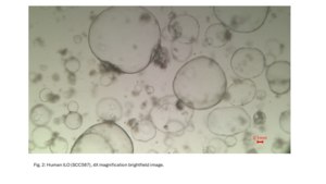 3dGRO® Human Liver Organoids (MNFBQ01LI (63-65)) Normal, Liver, Age: 60, Male, Mutation: None