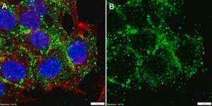 Anti-Profilin-1 Antibody, clone 1H21 ZooMAb&#174; Rabbit Monoclonal recombinant, expressed in HEK 293 cells
