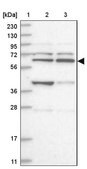 Anti-ZNF500 antibody produced in rabbit Prestige Antibodies® Powered by Atlas Antibodies, affinity isolated antibody, buffered aqueous glycerol solution