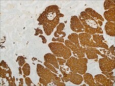 Cytokeratin 5 &amp; 6 (EP24 &amp; EP67) Rabbit Monoclonal Primary Antibody