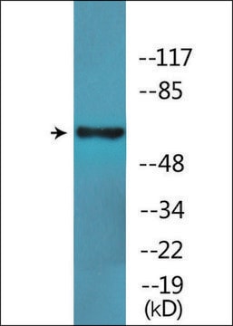 Anti-phospho-SLP-76 (pTyr128) antibody produced in rabbit affinity isolated antibody