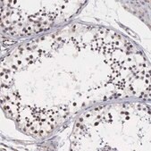 Anti-MORC2 antibody produced in rabbit Prestige Antibodies&#174; Powered by Atlas Antibodies, affinity isolated antibody, buffered aqueous glycerol solution